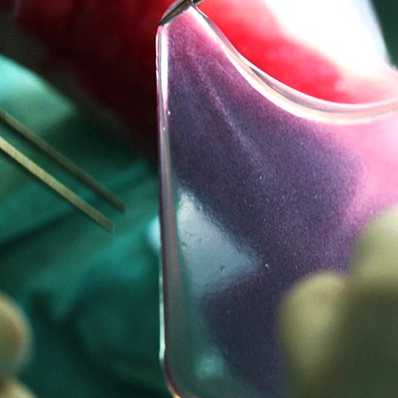 העור המהונדס שהציל חיים