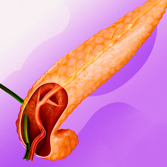 תאי גזע נגד סוכרת