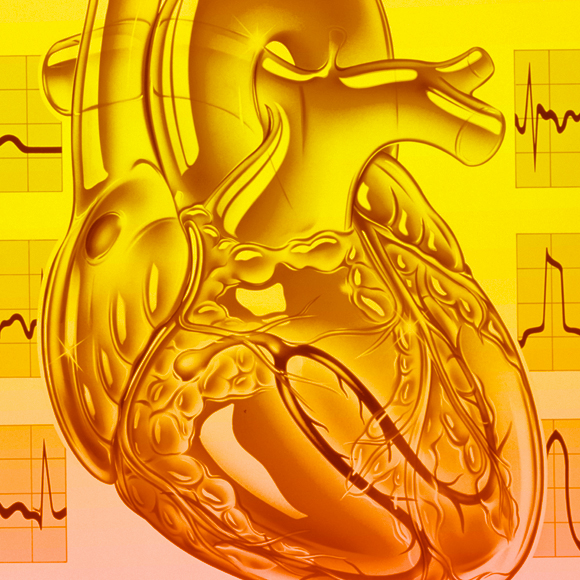 תיקון “קצרים” בלב באמצעות קרינה
