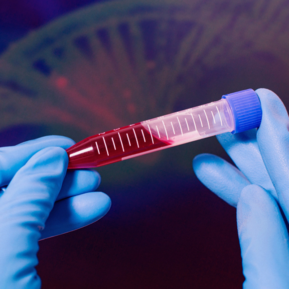 טיפול גֵני נגד המופיליה