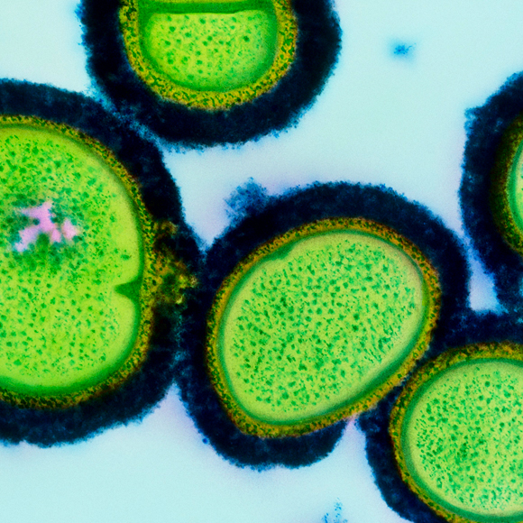 חיידקי העור שנלחמים בסרטן