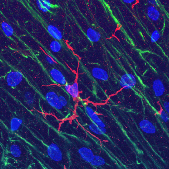 Losing control over the Brain’s Immune System