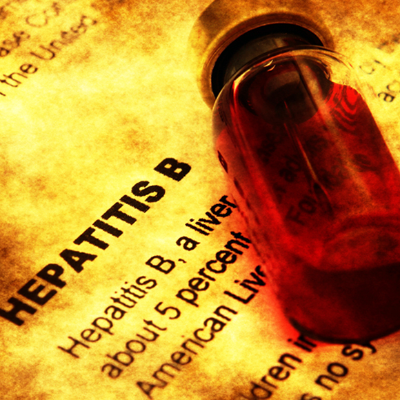 המחלה המודרנית של העת העתיקה