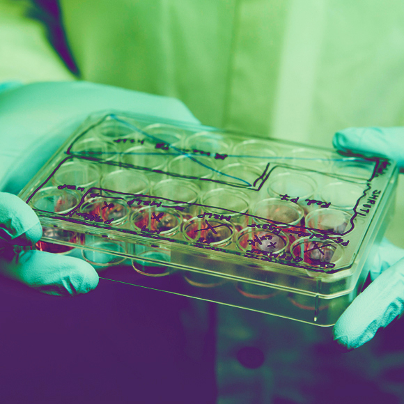 אחרי מאה שנה: נמצא ה”מארגן” האנושי