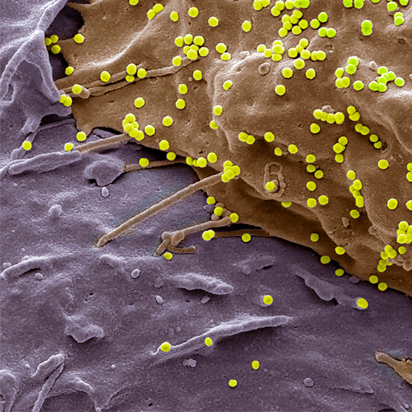 נגיפים נגד סרטן