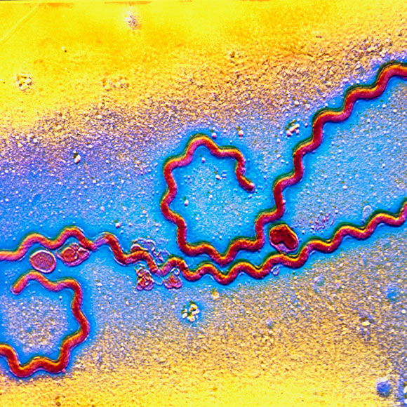 No Pleasure to Meet: Leptospirosis