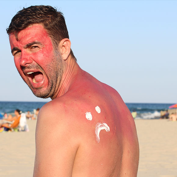 קרם הגנה – אתם עושים את זה לא נכון