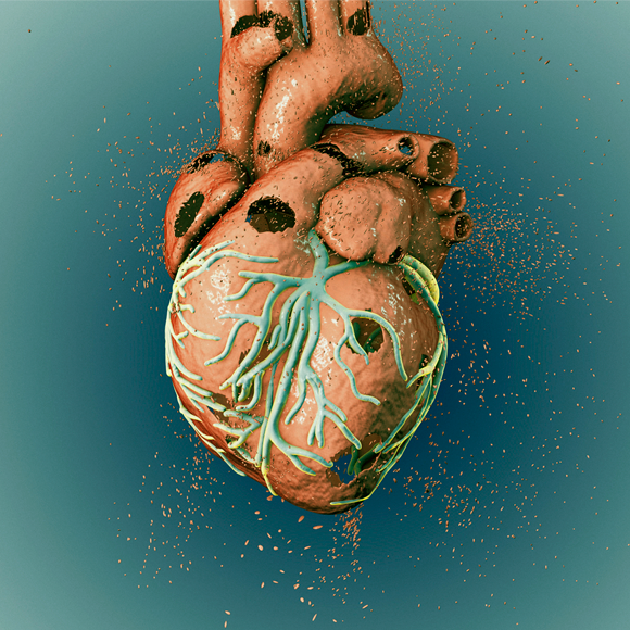 “עשית לי התקף לב”