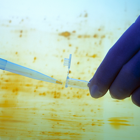 המרוץ לזיהוי החלבון