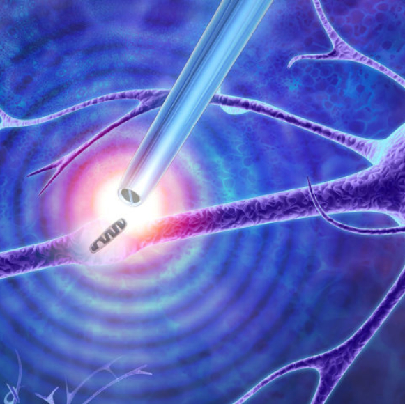 המלקחיים הקטנים ביותר