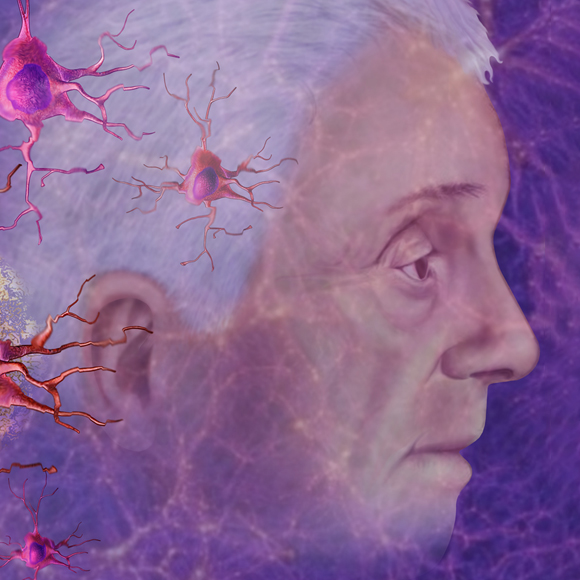 ערבוב הגנים המסוכן של המוח