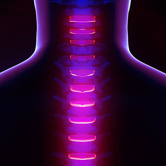 לקראת השתלת דיסק בעמוד השדרה