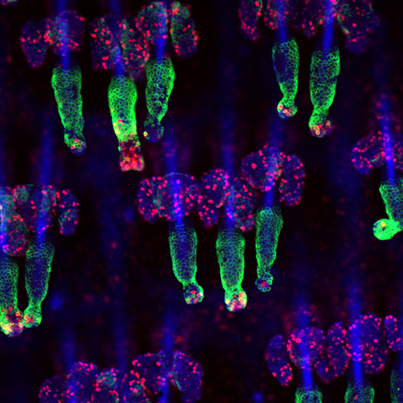 במותם ציוו לנו החלמה מהירה