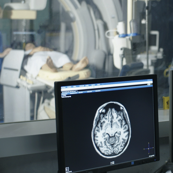 האם המוח של נשים מזדקן לאט יותר?