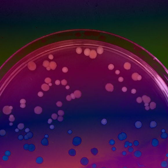 פיתוח חדש: חיידקים עמידים לקרינה