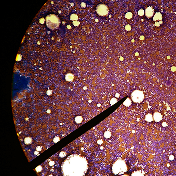 השתלת “בית חרושת חיסוני”