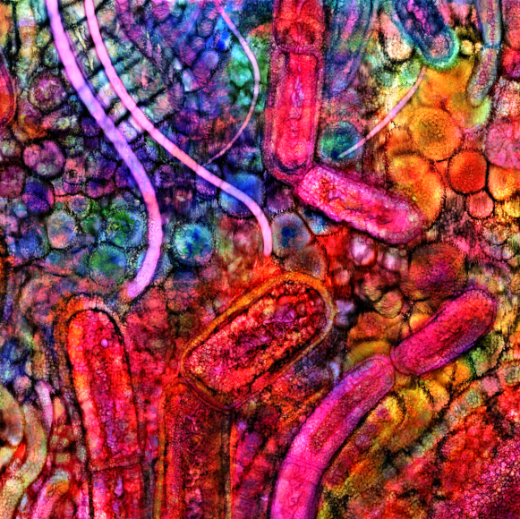 הפטריות שבתוכנו