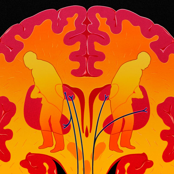 פרקינסון: לתפוס אותו כשהוא קטן