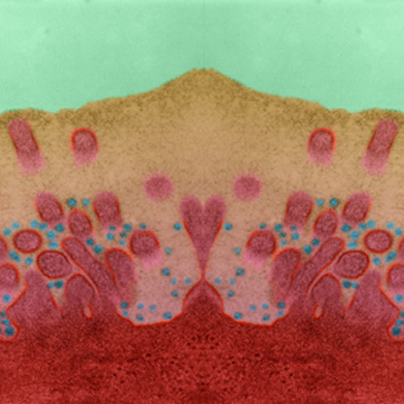 עקב אכילס של הנגיפים