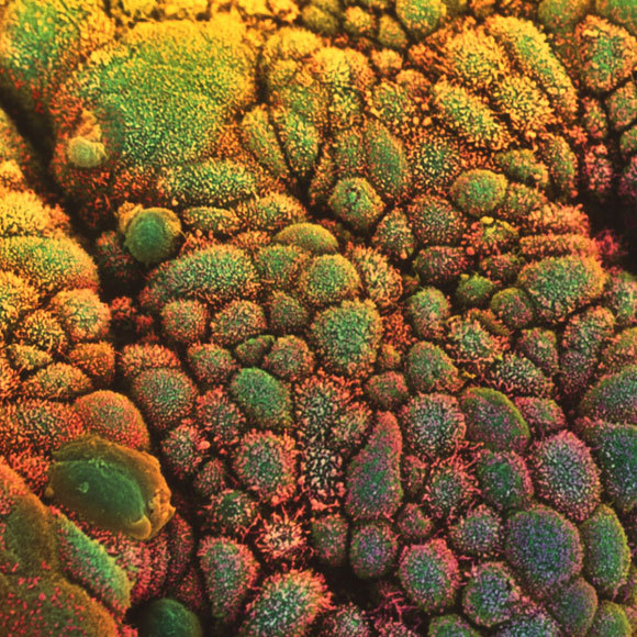 החלבון שמגן על המעיים מקרינה