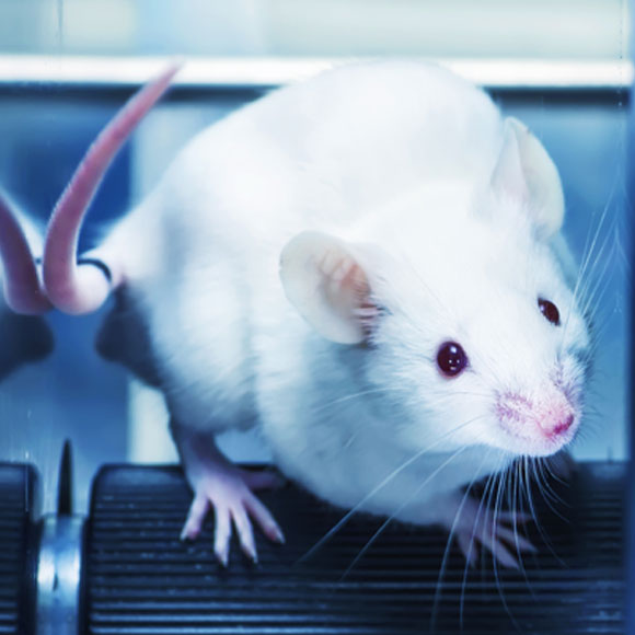 האם יש קשר בין חיידקי מעיים לאוטיזם?