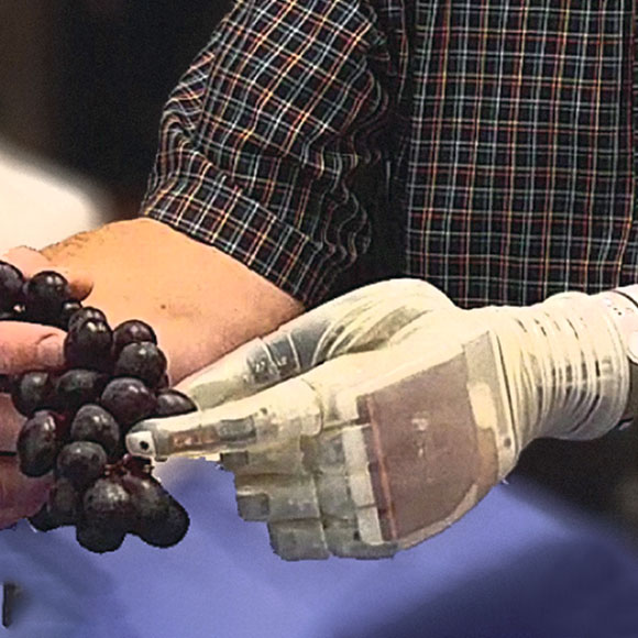 יד ביונית שמאפשרת לחוש