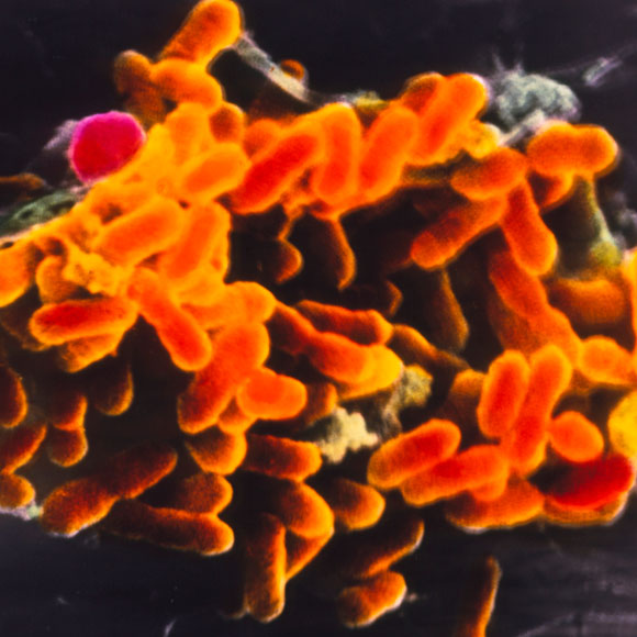 טיפוס – מחלת המלחמות