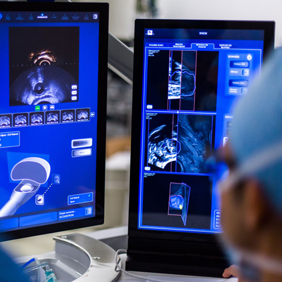 זהב נגד סרטן הערמונית