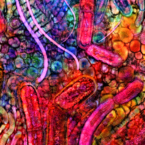 מערכת החיסון מונעת השמנה