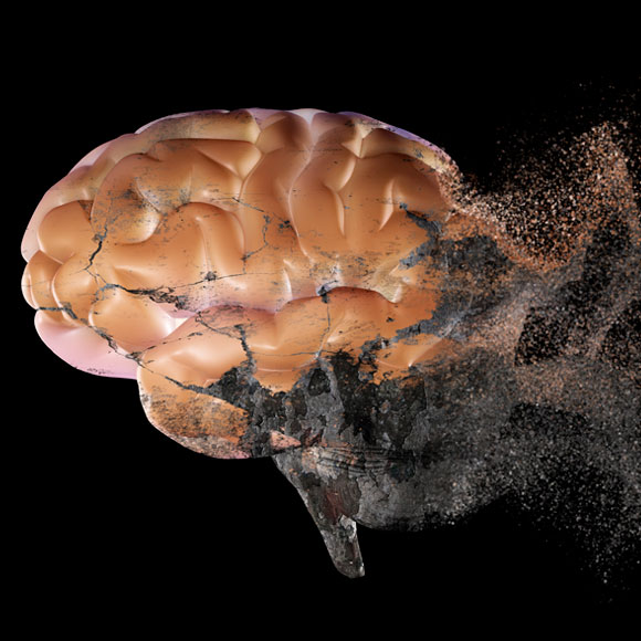 ליקוי בקשב וזיהוי מוקדם של מחלת אלצהיימר