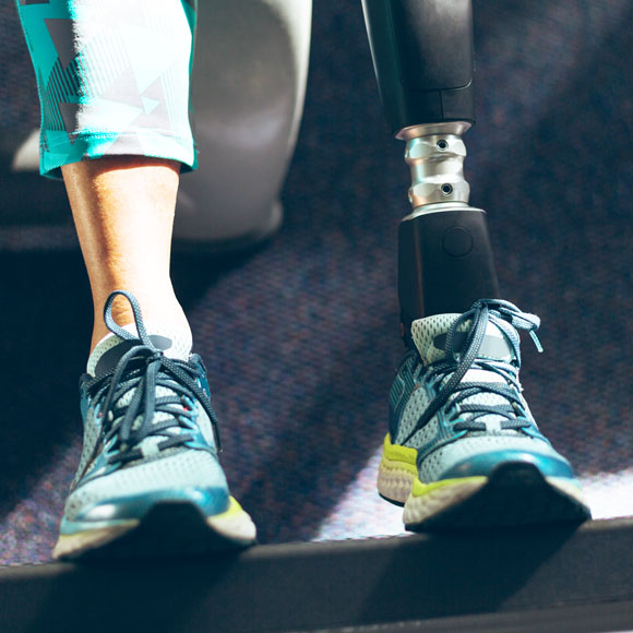 רגליים תותבות שגם מרגישות