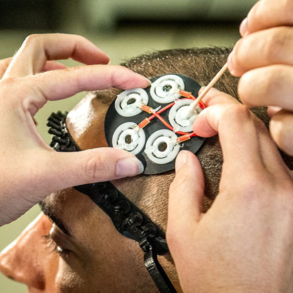 לזכור טוב יותר בעזרת גירוי חשמלי? לא בטוח