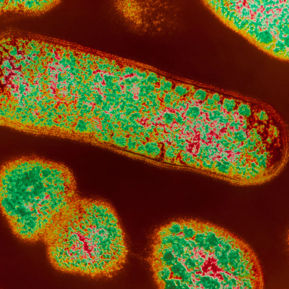 מחליפים את חיידקי הנרתיק