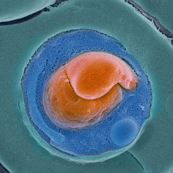 סודה של התרופה נגד מלריה