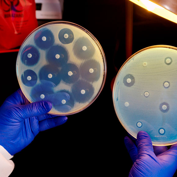 עוד חוזר הזיהום