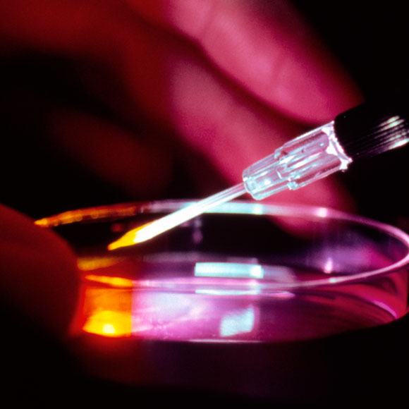 אופטימיות זהירה: ריפוי גני לאנמיה חרמשית