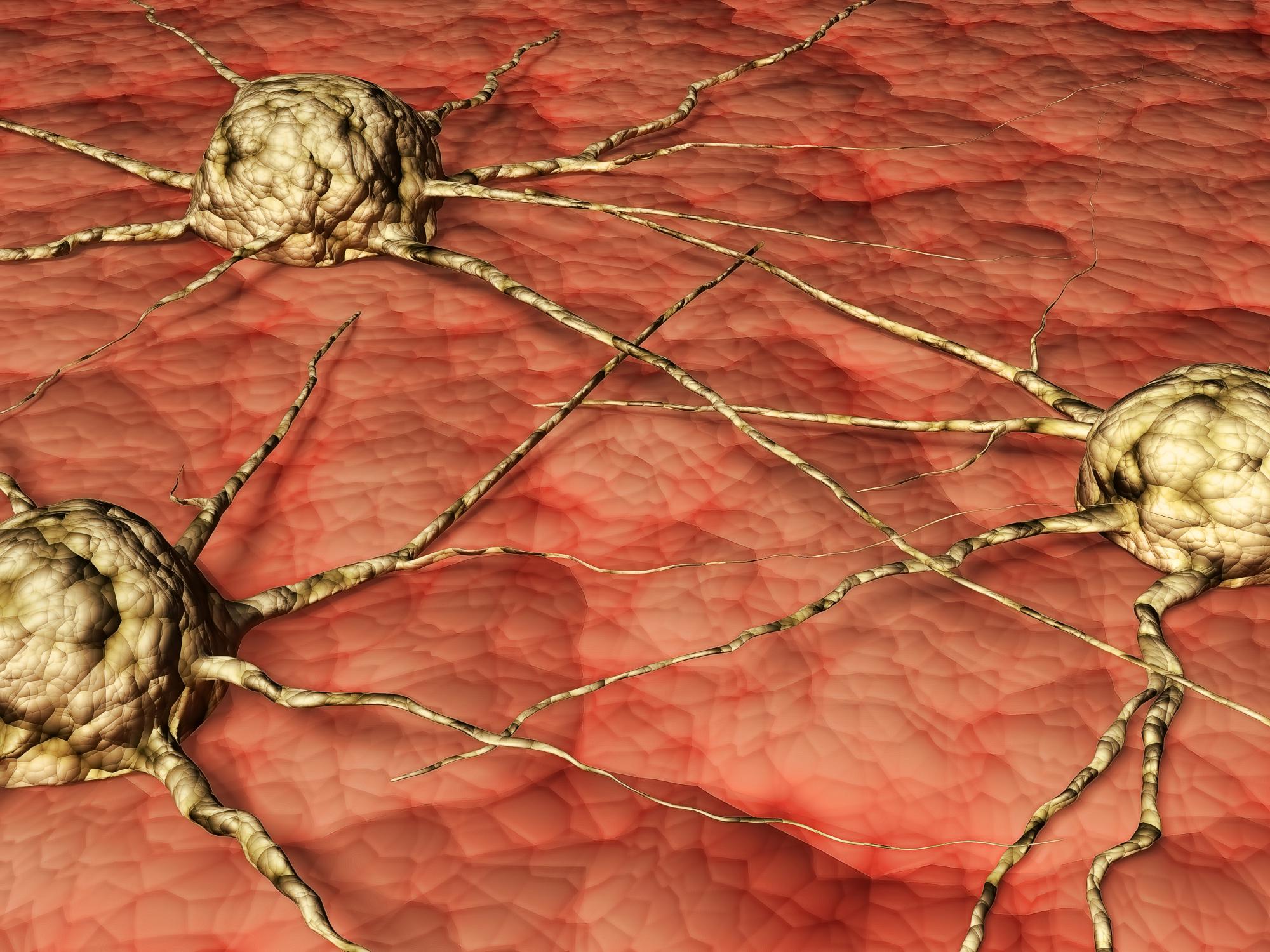 سرطان البروستاتا