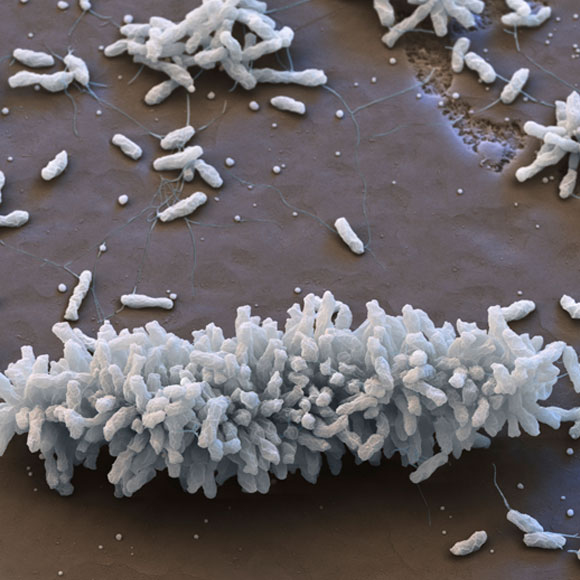 החיידקים שאוכלים חשמל