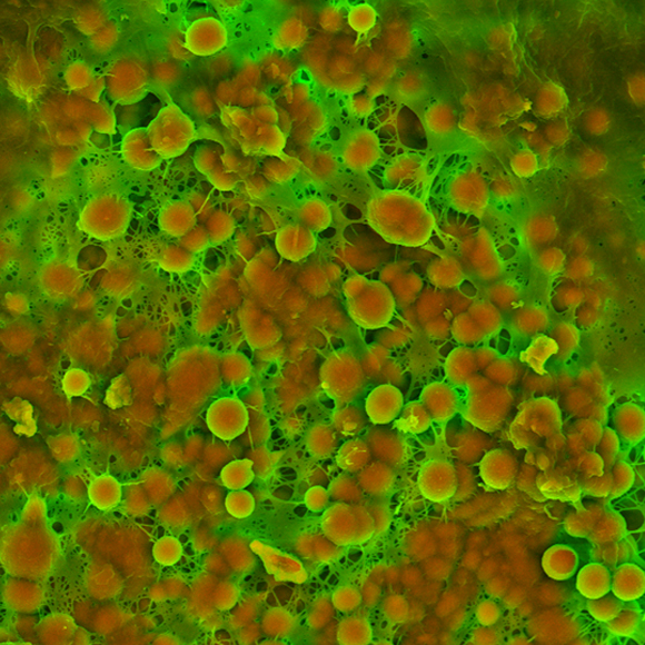 למה העורקים מסתיידים עם הגיל?