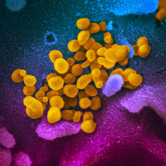 איך מאבחנים קורונה?