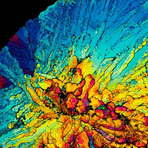 אינסולין מותאם אישית