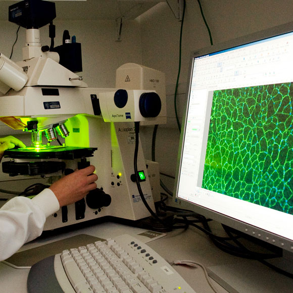 ה-RNA הקטן של ניוון השרירים