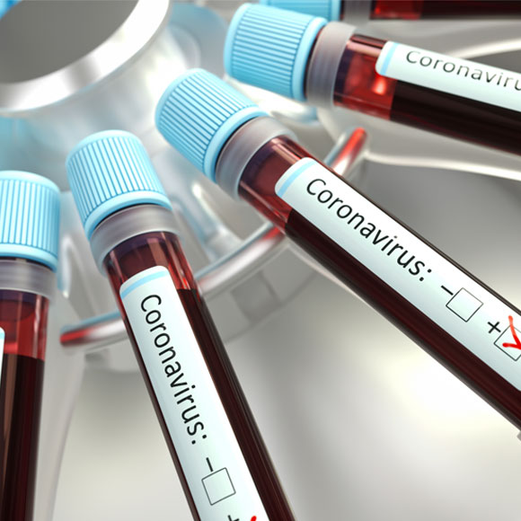 במי הקורונה פוגעת יותר?