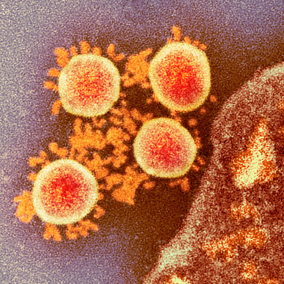 איך יודעים שנגיף הקורונה אינו מהונדס?