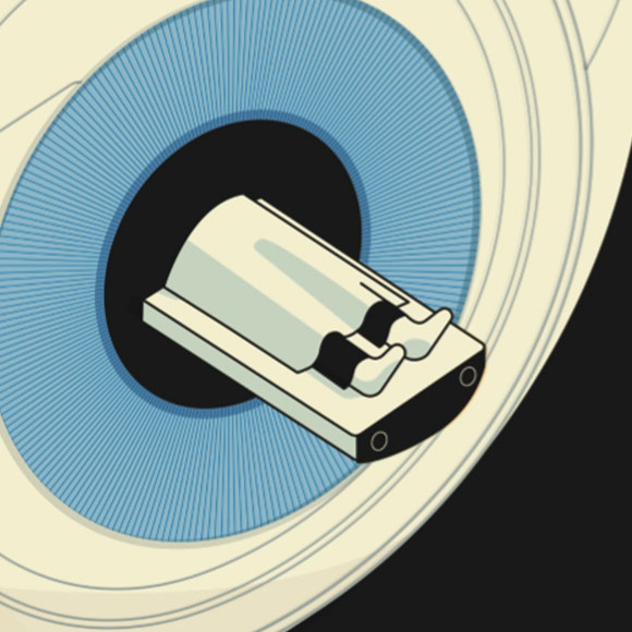 עלייתם של הרדיולוגים הרובוטיים