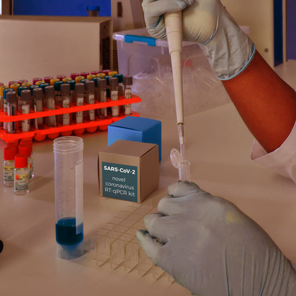 בדיקות הקורונה: מהם החומרים החסרים?