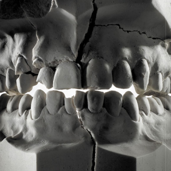 הצרה עם השיניים