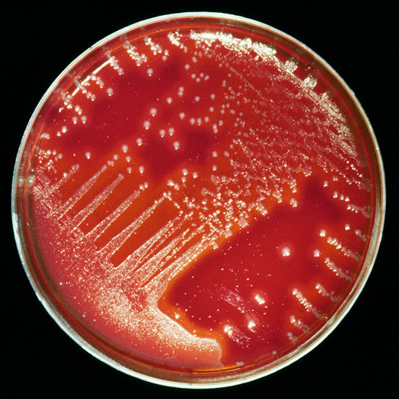 מלחמות חיידק בחיידק