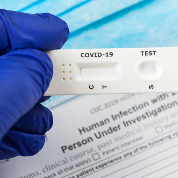 מה התועלת בבדיקות סרולוגיות?