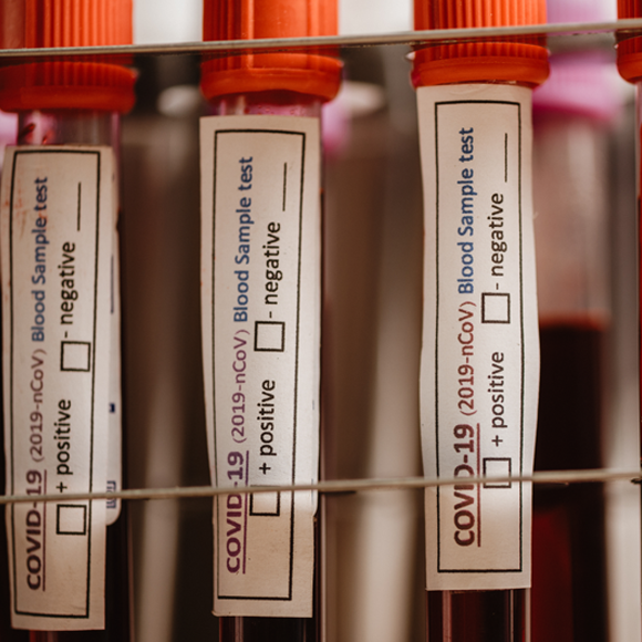 מגפת הקורונה: לבדוק את הבדיקות